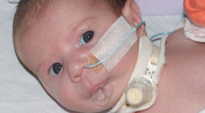 Pediatric Tracheostomy (trach) Care: Crucial Instructions